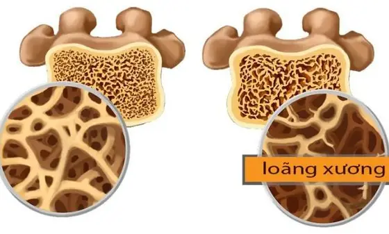 Lợi ích của hạt dưa Lợi ích của hạt dưa