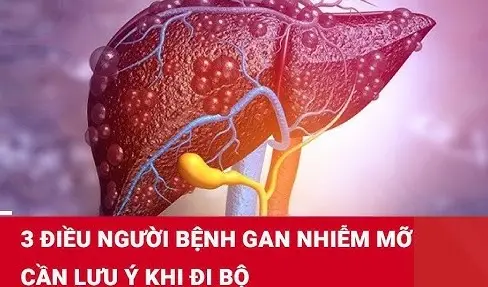 Các cấp độ của bệnh gan nhiễm mỡ