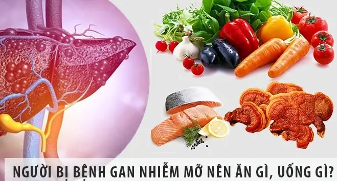 Nguyên nhân bị bênh gan nhiễm mỡ Nguyên nhân bị bênh gan nhiễm mỡ