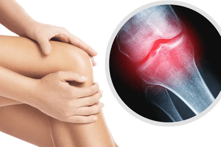 Tổng hợp các bệnh về xương khớp